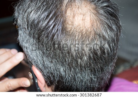 Mature man, seen from behind, in the head, begins to lose hair