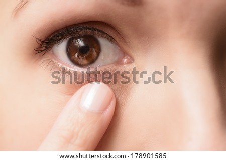 Contact lens in the eye of a female patient with the typical air bubble under the lens, extreme close up