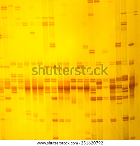 Plant DNA fingerprint on acrylamine gel electrophoresis result
