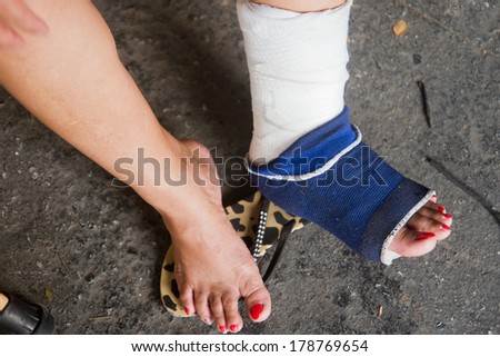foot splint for treatment of injuries from ankle sprain.