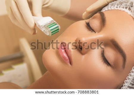 Beautiful woman in beauty salon during mesotherapy procedure.  Face microneedling treatment with a meso roller.