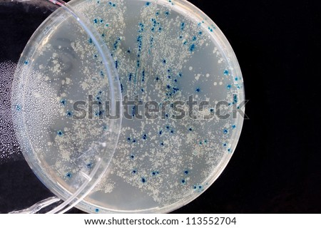 a Petri Dish with growing Virus and bacteria cells. microorganism
