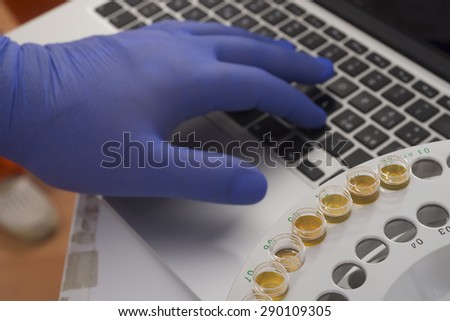 test lab for analysys - keyboard and test tube holeder with gloved hand