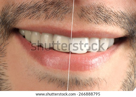 Teeth. Dental. Wide sincere smile
