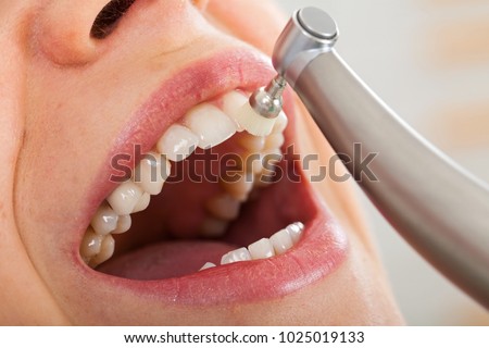 Professional dental cleaning, female patient\'s beautiful denture