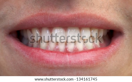 Close-up of man mouth with white teeth