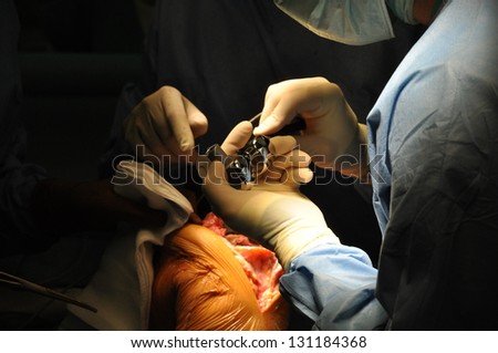 Prosthesis of the knee hospital operation