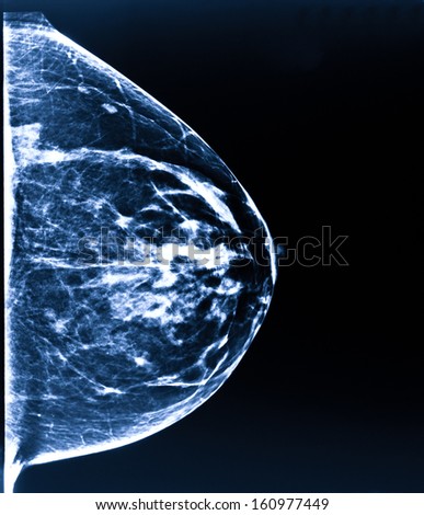 Mammography X-rays