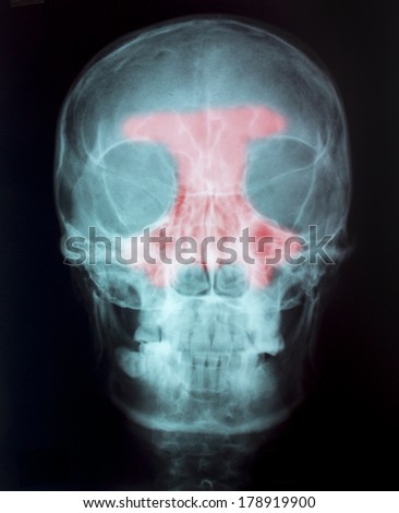 X-Ray Image Of Human  for a medical diagnosis