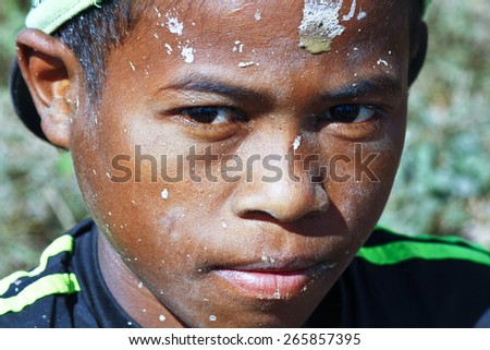 Hard working poor malagasy boy with dirty face - poverty in Madagascar