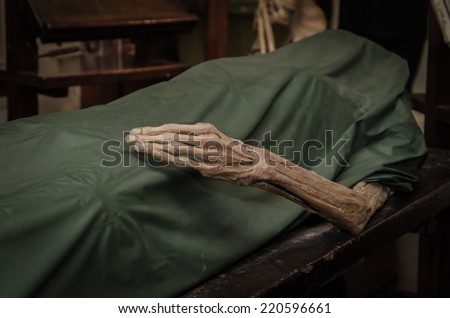 The dead body. Focus on hand decay.