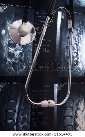 Stethoscope leaning against MRI of lumbar disc, all info is anonymous