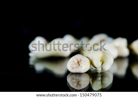 Extracted teeth - isolated black