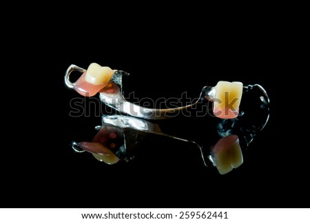 Metal base partial denture