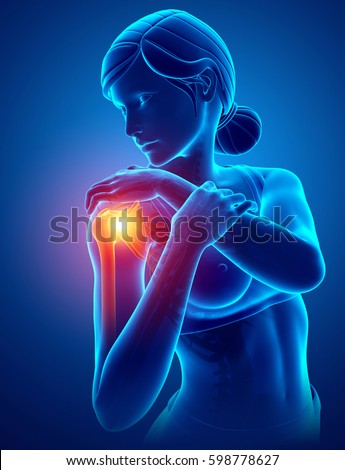 3d Illustration of Women Feeling the Shoulder Pain