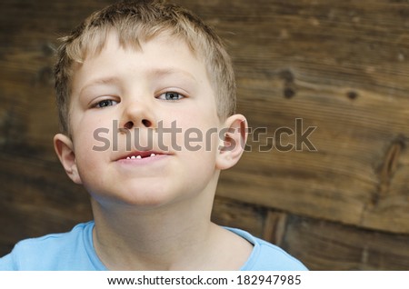 Cute young boy showing his missing tooth