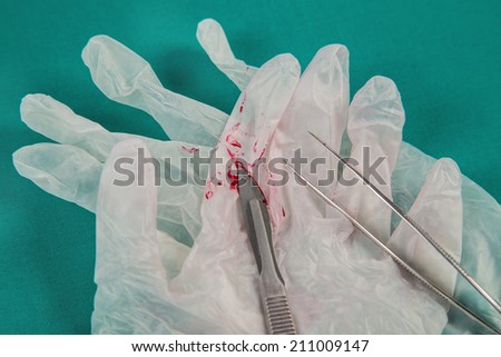 Surgical gloves and scalpel after surgery