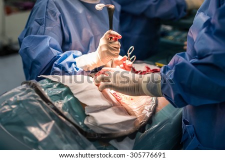 Classic cesarean section in the operating theater