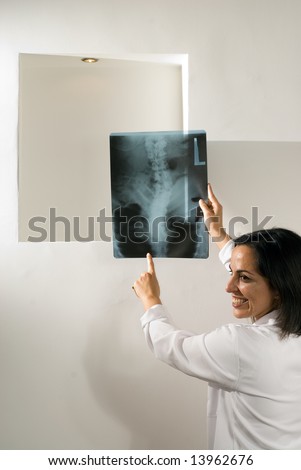 Smiling female doctor holding up an x-ray of a persons back pointing to the lower lumbar.  Vertically framed shot.