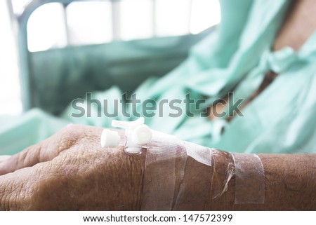 closeup of a Patient hand with Disposable Infusion