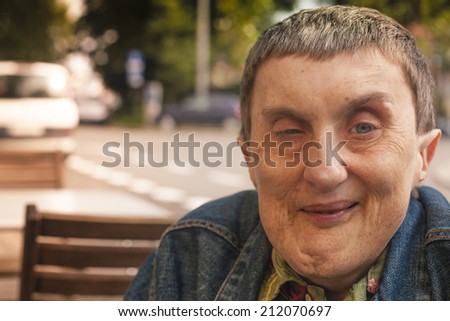 Closeup portrait of disabled man with cerebral palsy sitting at an outdoor cafe.