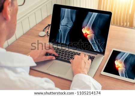 Doctor watching a laptop with x-ray with pain relief on a knee in a medical office in the morning light