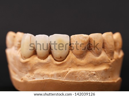 dental impression is located on the black background