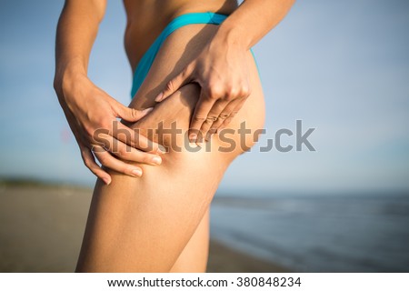 Woman is testing the skin for stretch marks and cellulite on the beach.Woman holding/showing cellulite area.Self consciousness,self confidence and body insecurity.Summer beach body.Cellulite removal