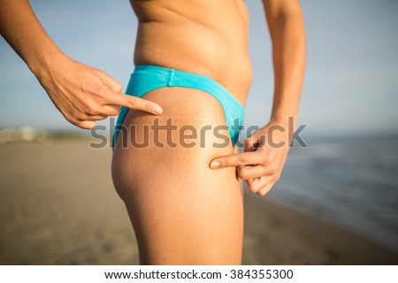 Woman is showing skin with stretch marks and cellulite on the beach.Woman showing cellulite problematic area.Self conscious,self confidence and body insecurity.Not toned.Flat curves and excess fat