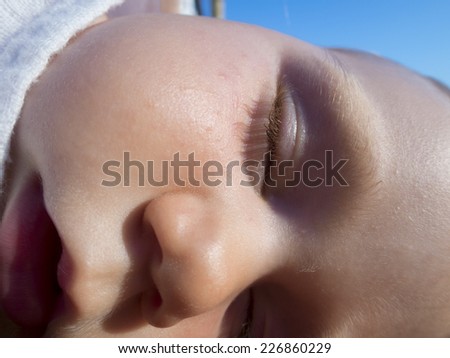 close-up face of baby eye nose mouth sleeping with irritated skin and grains