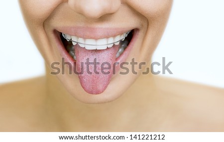 Beautiful smiling girl with retainer for teeth sticking her tongue out, on white