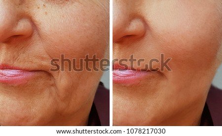 face wrinkle on old woman