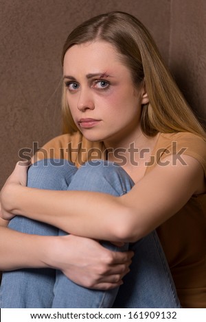 Portrait of scared woman with bruise on face. Idea of human traffic and sexual violence