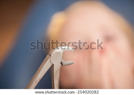 portrait of scared girl at dentist's office. dentist extracted tooth of little girl