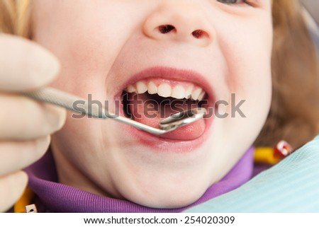 Close-up of little girl opening his mouth wide. Little girl is having her teeth examined by dentist