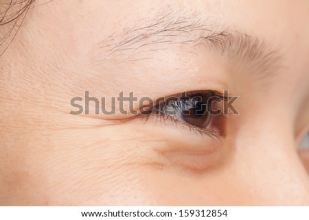 Middle-age woman face closeup wrinkles