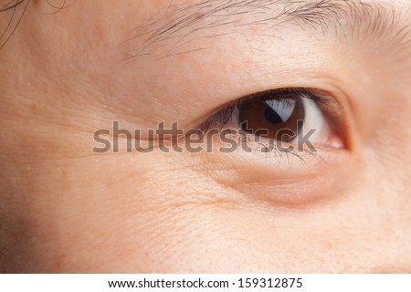 Middle-Age Woman Skin Closeup Wrinkles