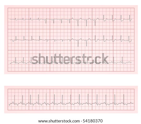 ecg is a simple Ecg+scan