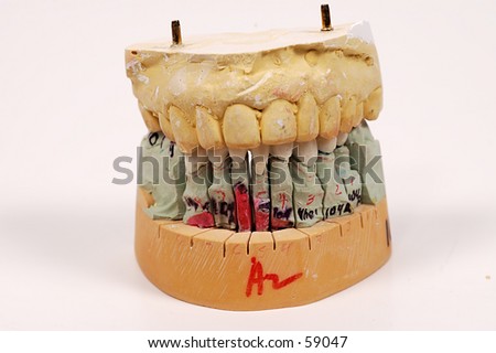 mouth cast