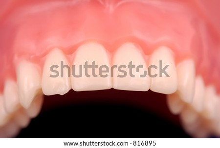 Straight and Aligned Upper Teeth