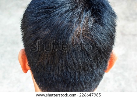 Hair loss on blur background