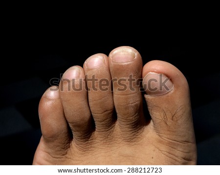 Closeup of a human foot and toes