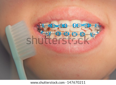 happy girl with braces brushing her teeth