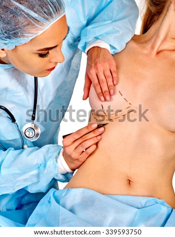 Augmentation breast cancer surgery. Female doctor makes dotted line on female body on isolated.