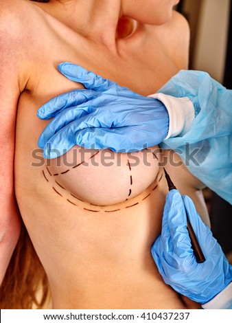 Doctor makes dotted line on female breast .