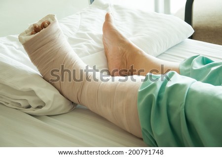 Broken Leg