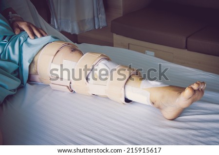 woman wearing a leg brace, Broken leg