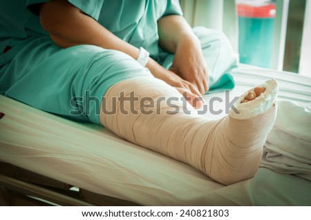 Injured woman with cast Broken Leg, bad day, insurance concept