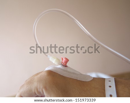 Arm of a male patient in the hospital with an iv intravenous drip