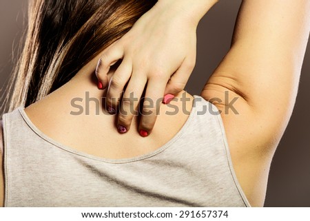 Health problem. Closeup young woman scratching her itchy back with allergy rash